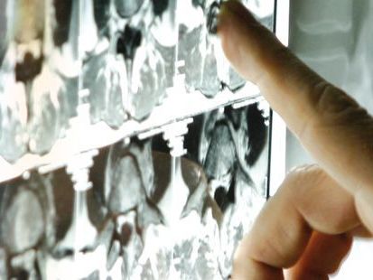 Radiologie: Gezielte Untersuchung von Rücken, Herz und Prostata